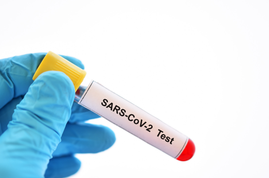 Sars Cov 2